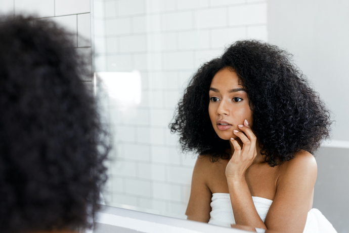 The Truth About Acne and Dry Skin